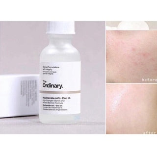 The Ordinary - Niacinamide 10% + Zinc 1% - 30ml